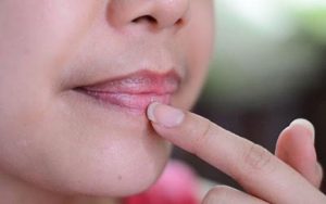 Phun môi 2 tuần bị thâm khiến khuôn mặt kém sắc