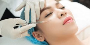 Tìm hiểu tiêm filler má bao nhiêu cc và bao nhiêu tiền