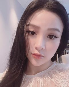 Lượng filler cần tiêm cho má sẽ phù thuộc vào cơ địa mỗi người