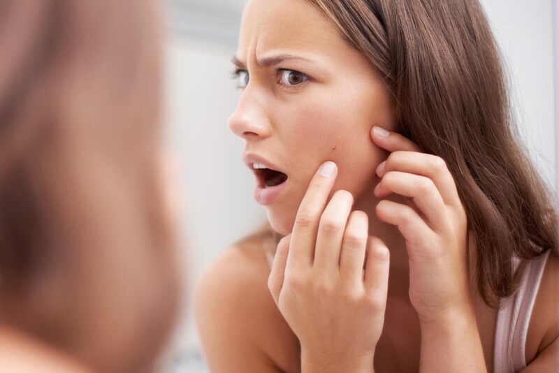 Trang điểm gây bít tắc lỗ chân lông khiến cho da dễ nhiễm khuẩn hơn