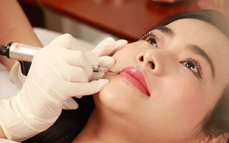   Nên lựa chọn những đơn vị uy tín và chất lượng