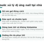 4 bước xử lý dị ứng nail tại nhà