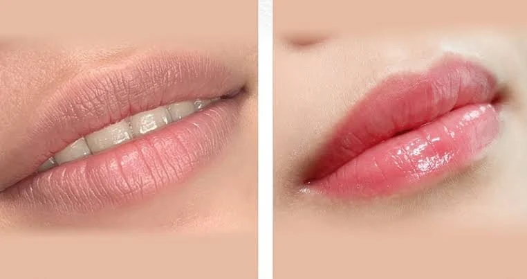 Những hiểu lầm phổ biến nào về môi thâm sau phun?