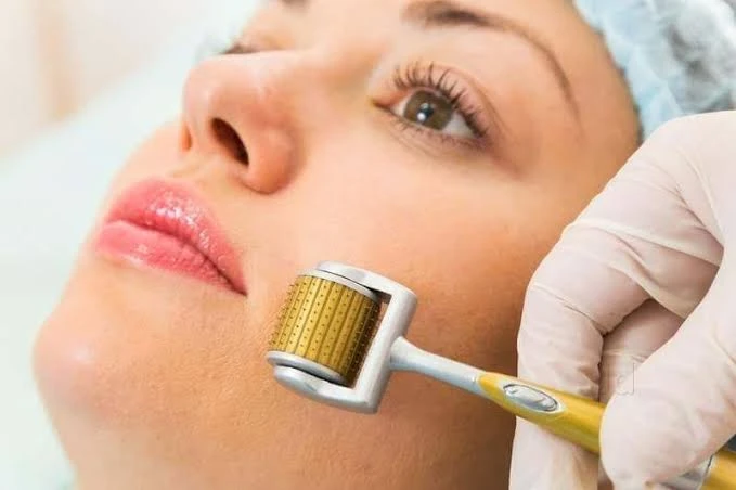 Lăn kim da mặt hoạt động như thế nào?