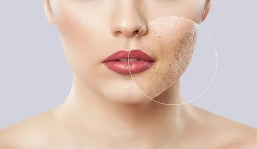 Tại sao tẩy da chết quan trọng cho làn da?