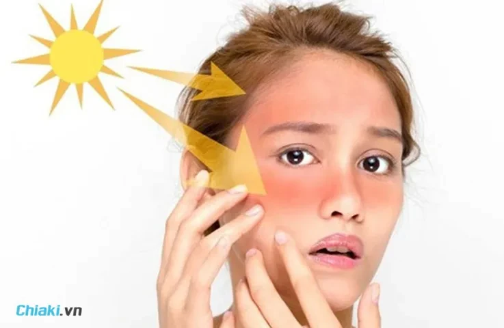 Mặt nạ và liệu pháp tự nhiên giúp phục hồi nhanh