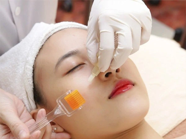 Những hiểu lầm phổ biến về lăn kim