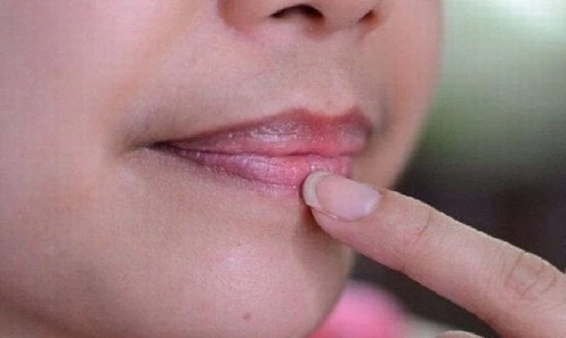 Khi nào nên gặp bác sĩ để trị thâm chuyên nghiệp?