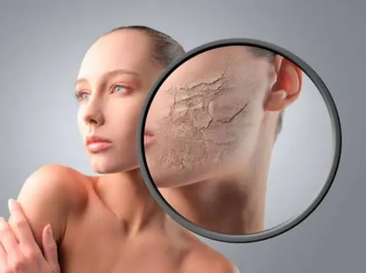 Làm thế nào để nhận biết da thiếu nước qua triệu chứng?