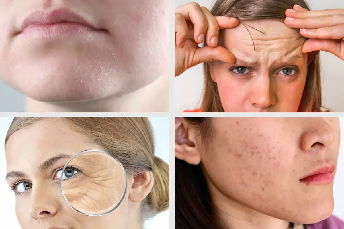Nguyên nhân chính khiến da lão hoá sớm là gì?