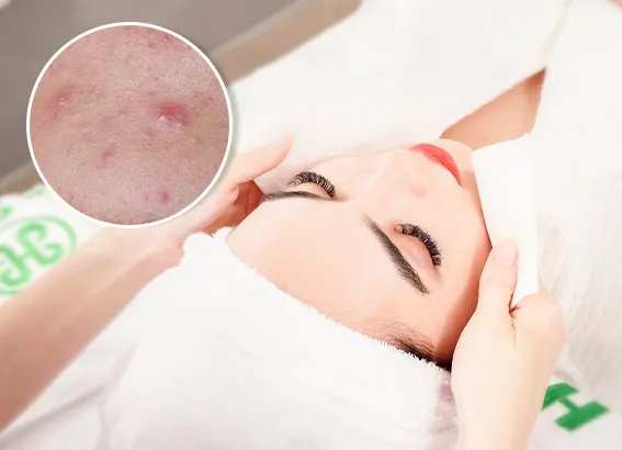 Nên dưỡng ẩm và bảo vệ da từ ngày thứ 2-3 như thế nào?