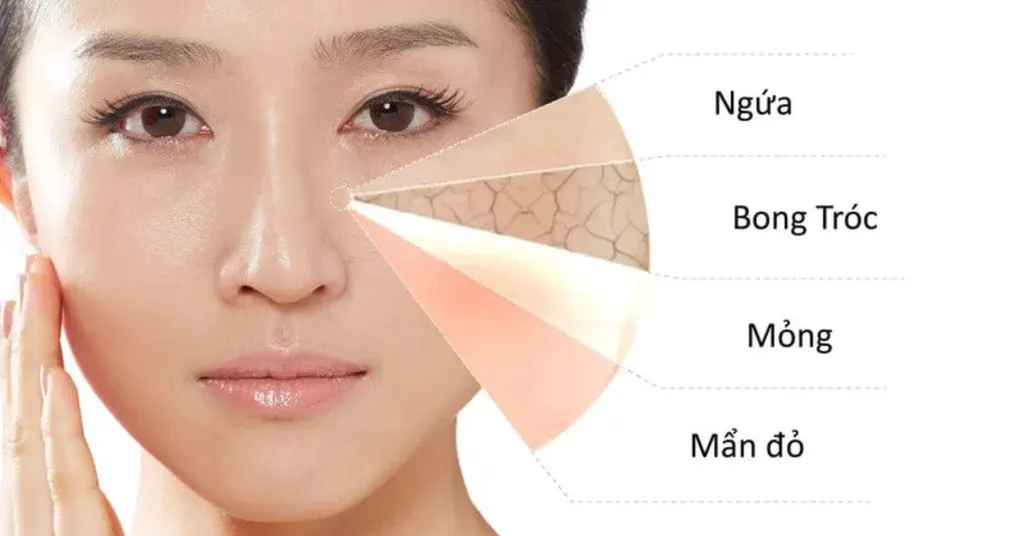 Không nên dùng mỹ phẩm hết hạn vì lý do gì?
