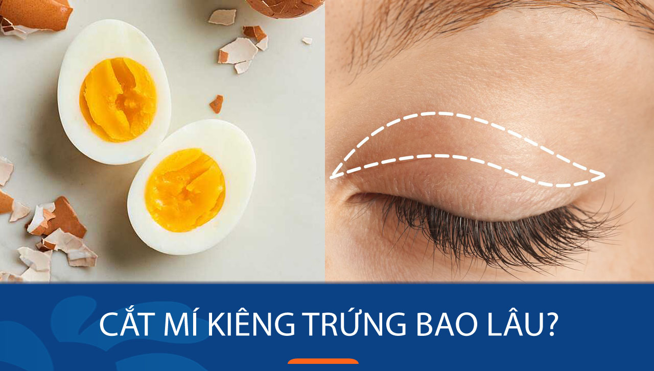 bạn cần kiêng ăn trứng tối thiểu từ 2 đến 4 tuần sau khi phẫu thuật