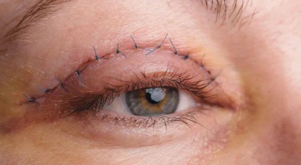 Nên luôn trao đổi với bác sĩ nếu có lo ngại.