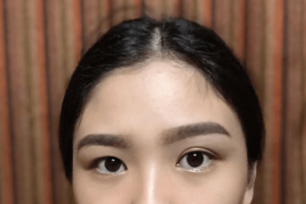 Nếu bạn quyết định chỉnh sửa, có hai điều quan trọng cần chuẩn bị tâm lý.