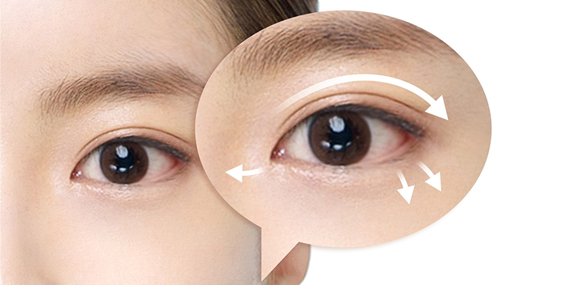 Sau cắt mí, bạn thường có thể đi làm lại sau khoảng 7–10