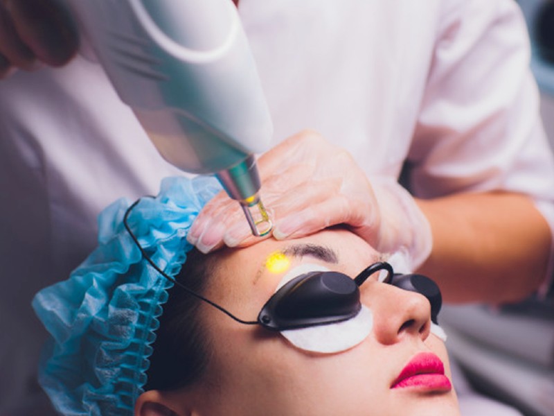 Xóa xăm lông mày laser có để lại sẹo không? Cách phòng tránh