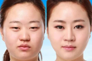 Cách vẽ eyeliner cho mắt sụp mí giúp mắt to tròn