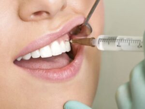 Trước khi lấy tủy, bác sĩ sẽ tiêm thuốc tê lên răng để kiểm soát cơn đau.