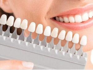 Bạn có thể bọc răng sứ 1 chiếc nếu đủ điều kiện về mặt sức khoẻ