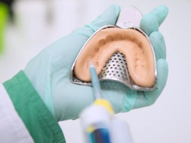 Bác sĩ tiến hành lấy dấu hàm thật và gửi về phòng labo vô khuẩn để chế tác răng sứ