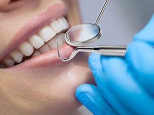 Kỹ thuật bọc răng sứ không đảm bảo, tạo điều kiện cho vi khuẩn xâm nhập gây mất màu răng sứ.