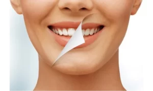 Bọc răng sứ là kỹ thuật phục hình răng hiện đại, áp dụng cho nhiều trường hợp