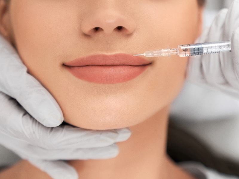 Tiêm môi hay cắt môi phụ thuộc vào quyết định, mong muốn của khách hàng