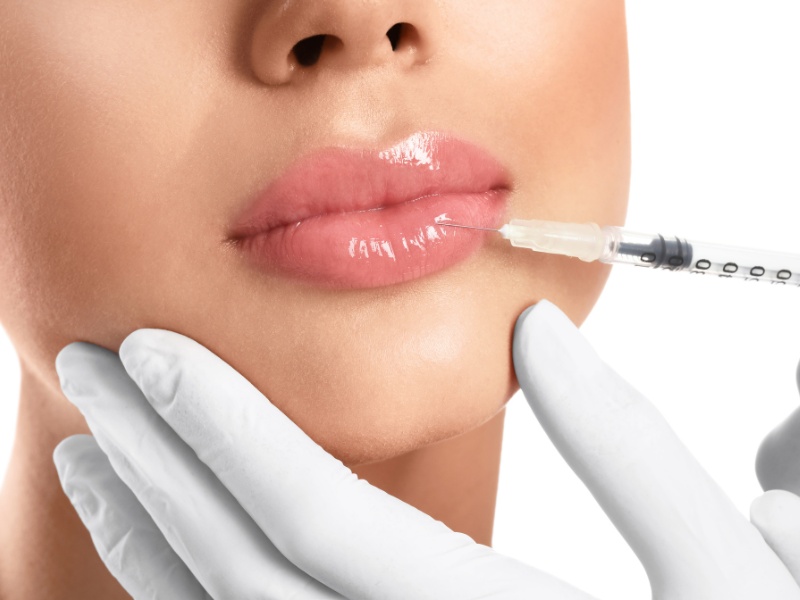 Dáng môi tròn, căng mọng tạo ra sự hài hòa với gương mặt