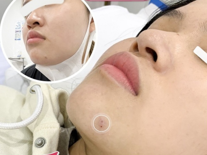 Bạn nên trị sẹo tại các địa chỉ làm đẹp uy tín, có đầy đủ tiêu chí theo quy định