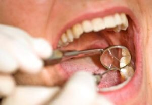 Làm thế nào để chăm sóc và kiêng kỵ sau lấy tủy?