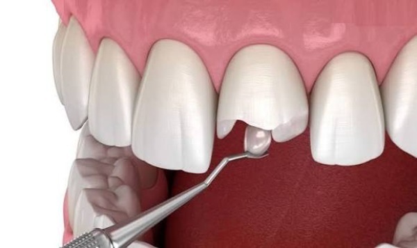 Điều gì sẽ xảy ra nếu không xử lý?