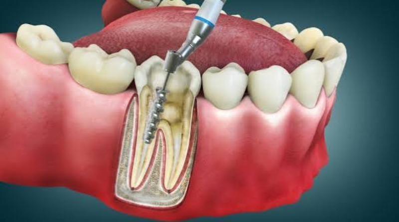 Lấy tủy sống và lấy tủy chết có điểm gì khác nhau?