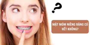 Mặt móm niềng răng có hết không? Niềng răng móm có đau không?