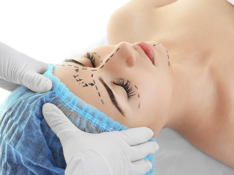 Phẫu thuật mặt trái xoan giúp gương mặt trở nên hài hòa và thẩm mỹ hơn