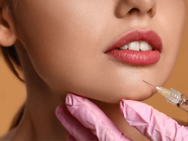 Bác sĩ sẽ đưa chất làm đầy vào cằm, nhằm cải thiện nhược điểm cằm lệch, thô