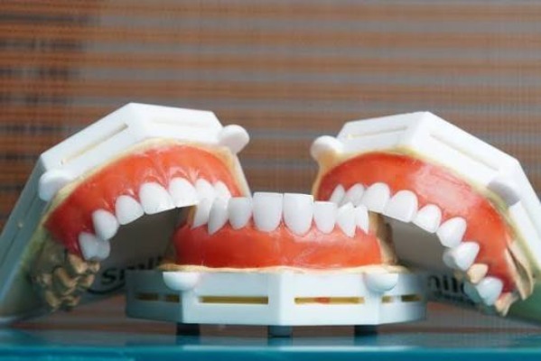 Bọc sứ dùng được bao lâu?