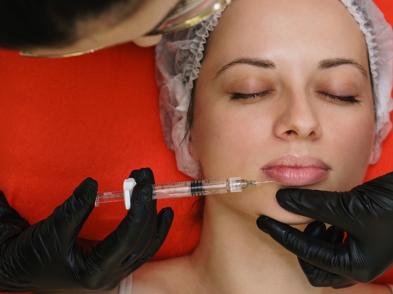 Tiêm filler môi tại địa chỉ kém uy tín làm tăng nguy cơ gặp biến chứng nguy hiểm