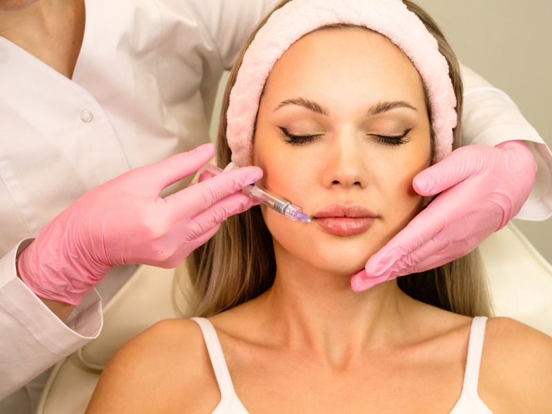 Tiêm filler tạo hiệu ứng khóe môi khi cười sẽ tăng thêm nét đẹp trẻ trung, tươi tắn