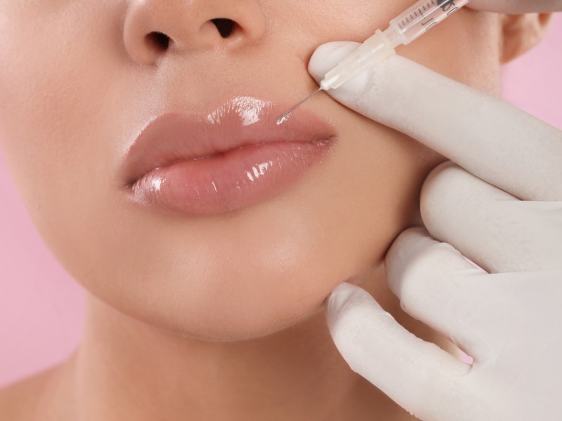 Nếu bạn muốn phun môi thì cần lựa chọn loại filler đảm bảo chất lượng