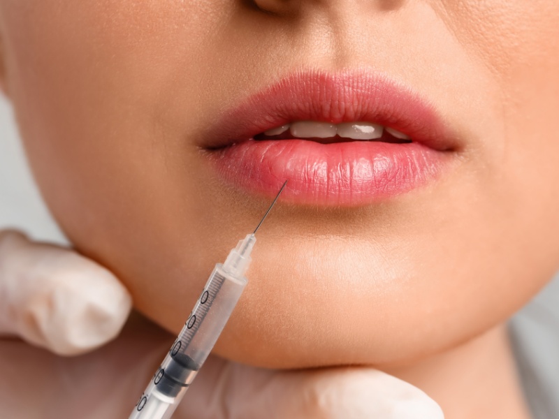 Sau khi tiêm filler môi, bạn nên kiêng một số việc làm, thực phẩm ảnh hưởng đến hiệu quả làm đẹp