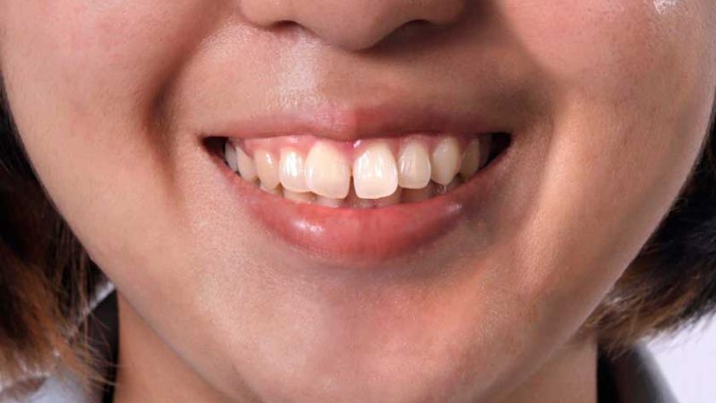 Tình duyên của người mặt hô không mấy suôn sẻ, hạnh phúc