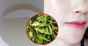Xông mặt bằng lá đinh lăng để sở hữu làn da trắng sáng
