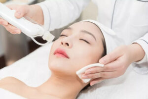 Aurora sử dụng đa dạng nhiều công nghệ trị mụn hiệu quả như lăn kim, sử dụng tia laser,...