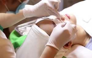 Nặn mụn có cần thiết không?