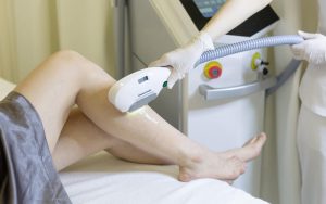 Triệt lông vĩnh viễn sử dụng công nghệ ánh sáng để triệt lông