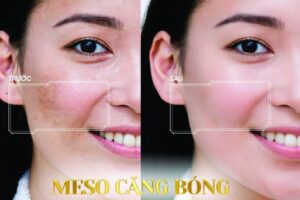 Genus Spa với trang thiết bị hiện đại và đội ngũ chuyên nghiệp Genus Spa với trang thiết bị hiện đại và đội ngũ chuyên nghiệp