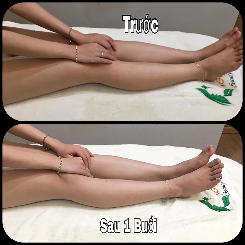 Hình ảnh quy trình tắm trắng bằng công nghệ ánh sáng sinh học hiện đại