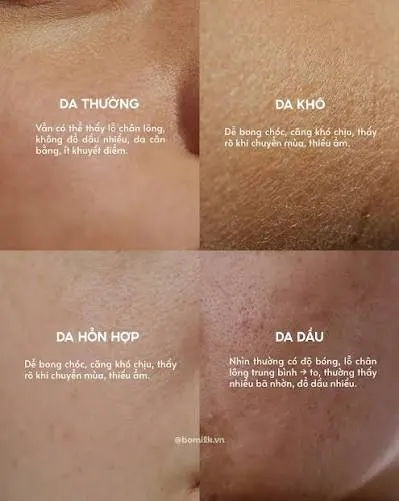 Vì sao cần hiểu đúng về phân biệt da dầu, da khô, da hỗn hợp?