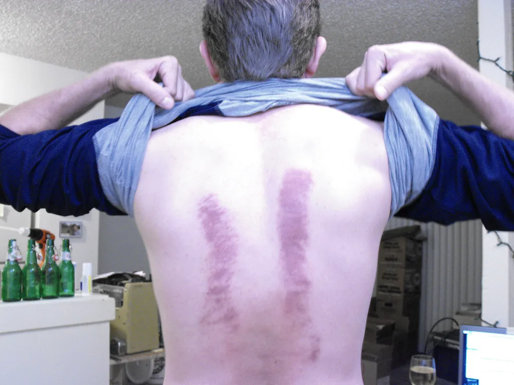 Massage mô sâu khác massage thư giãn và massage trị liệu như thế nào?